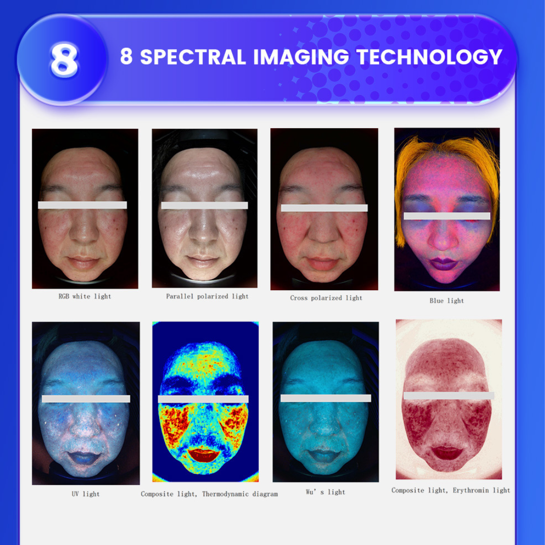 Mia-Face Skin Analyzer Machine